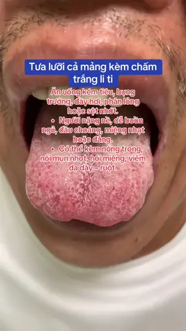 #thapnhiet #baithuocdangian #yhoccotruyen #traonguocdaday #xuhuong 