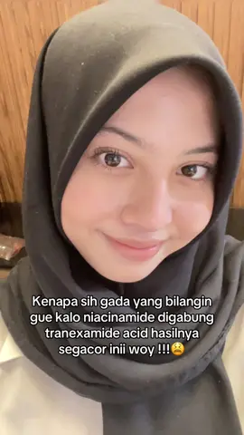 nyoba punya glowbomb gila si .. hasilnya glowing bgt bgt 😔😔🩷