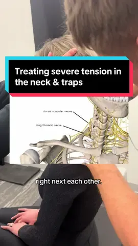 Got stubborn trap pain going into the neck? Especially with moving the arm or neck around? This one is for you! Get the ultimate release with Adhesion release methods 🙌🏻 Nerve entrapments are our bread and butter! Precise & effective manual methods for pain relief are here and they are attainable!   If you have tried Chiro, PT, stretching, acupuncture, massage, etc.. and can’t seem to find that lasting relief… Adhesion could be your problem and could be stopping you from getting to that goal! 👉🏻 we fix muscle, nerve, and joint pain! We also see chronic tightness, headaches, TMJ, numbness, tingles.. etc.  🔹 Adhesion acts like glue, sticking your muscles, nerves, and soft tissue together—limiting movement, causing weakness, and causing pain. 🔹 We manually break it down to restore normal function 🧑‍⚕️We have gotten patients to avoid surgeries, pills, and injections..  🚨It’s time to try something that’ll give you some lasting relief!!🚨 Get checked for adhesion asap!!  💬 DM us or call to book your consultation  #chronicpain #painrelief #nervepain #adhesionrelease #health