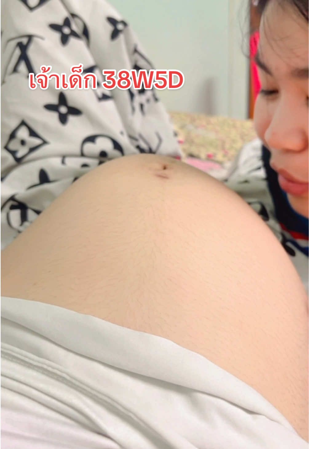 #38W5D เจ้าหนูดิ้นเก่งสุดๆ เริ่มมีอาการเจ็บท้อง ท้องแข็งบ้าง เวลาดึกๆ ตี2-3 จะชอบแข็ง แล้วหายไปเอง น้องเตือนแล้วใช่ไหมคะแม่ๆ น้องคุยเก่งมาก ดิ้นเก่งที่สุด #ทีมลูกสาวคนแรก👸 #ทีมตุลาคม🤰🏻#ฟีดดดシ #แม่มือใหม่ 