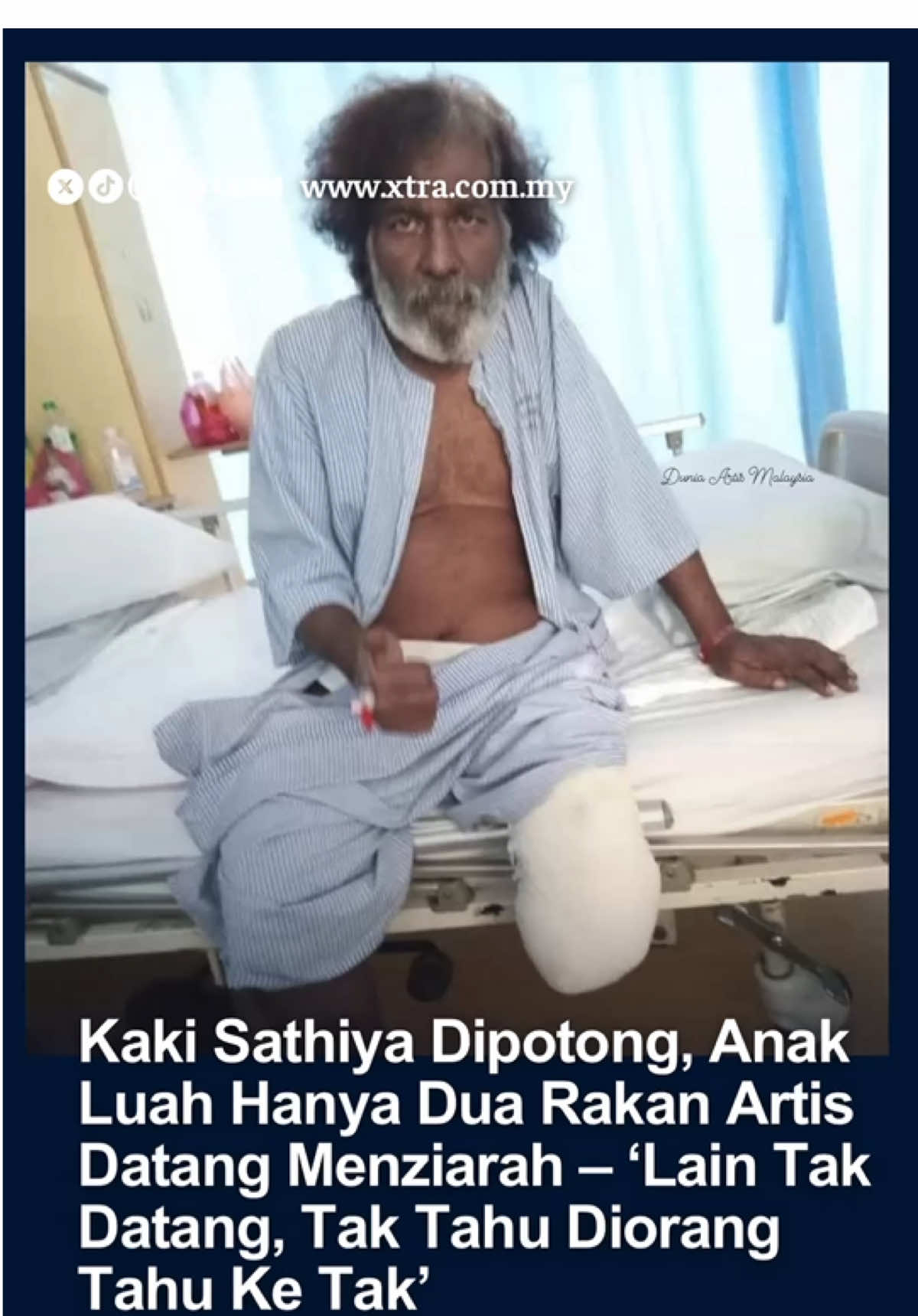 Pelakon & pelawak veteren, Sathiya selamat jalani pembedahan potong kaki kiri di Hospital Ampang. Anak sulungnya, Amani dedah ayahnya kini stabil tapi masih dipantau.  Namun lebih mengejutkan, hanya dua rakan artis saja yang datang menziarah! Netizen mula persoal ke mana hilangnya teman-teman seperjuangan seni. Foto terkininya yang dikongsi di media sosial meraih simpati ramai apabila netizen membanjiri ruang komen dengan doa serta kata-kata semangat.  Insiden ini sekaligus mencetuskan perhatian orang ramai yang berharap agar lebih banyak bantuan dan sokongan diberikan kepada artis veteren yang sedang memerlukan. #sathiya #pelawak #potongkaki #pelakon #pimaipimaitangtu 