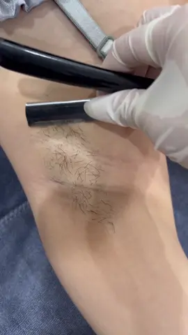 Sạch mịn từ gốc đến ngọn - tự tin khoe da xinh rạng rỡ. 🤩 #trietlonguytin #trietlongbacgiang #trietlongcongnghelgcool #lamdepkhongkho 