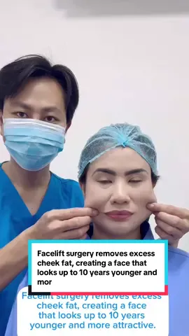 Facelift surgery removes excess cheek fat, creating a face that looks up to 10 years younger and more attractive.