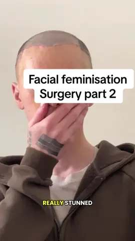Lil look at 7 days on from ffs.  Although such a big physical change and process to go through, the main thing on this day was emotions. When I got home, it poured outta me. That video ia coming shortly.xx #ffs #trans #transgender #surgery #genderaffirmingcare 