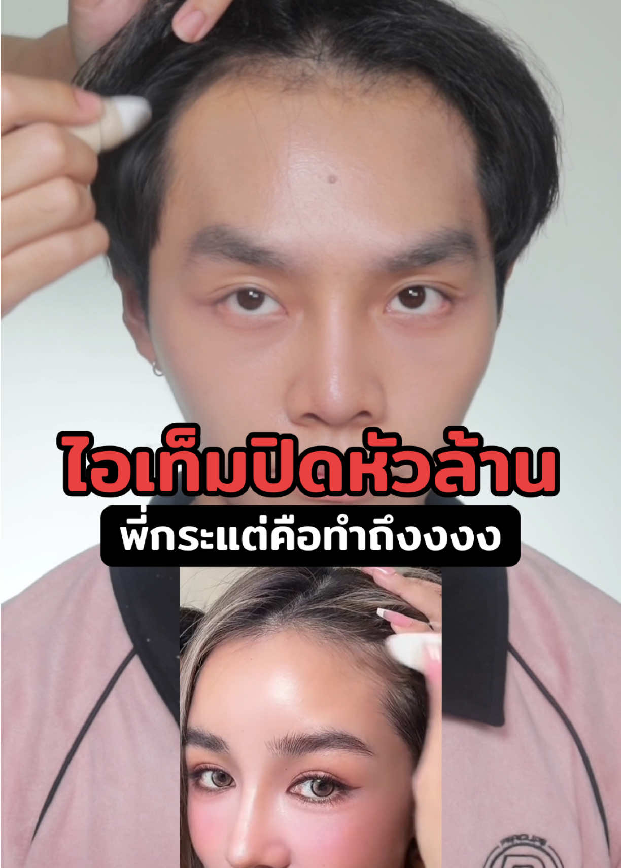 ที่ปิดหัวล้านพี่กระแต ค่ตเริ่ดดดดดดดดดดด คนหัวล้านผมบางต้องลองง 