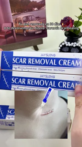 #scar #SelfCare #tiktokshopsummerturnup #fypシ #skincare 