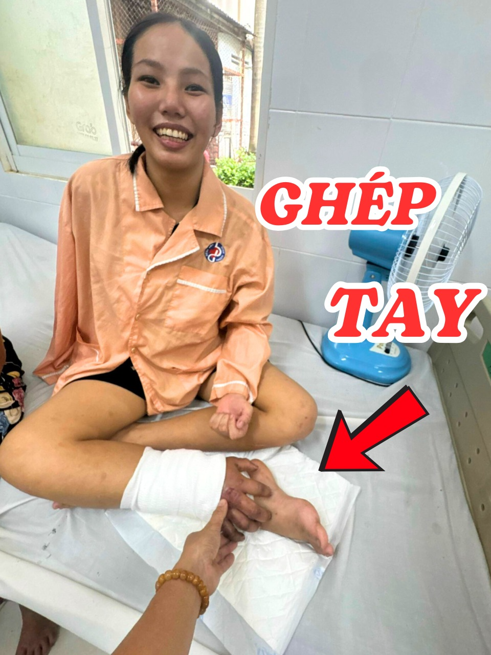 Pha xử lý chưa từng có ở Việt Nam để giữ cánh tay người mẹ đang mang song thai