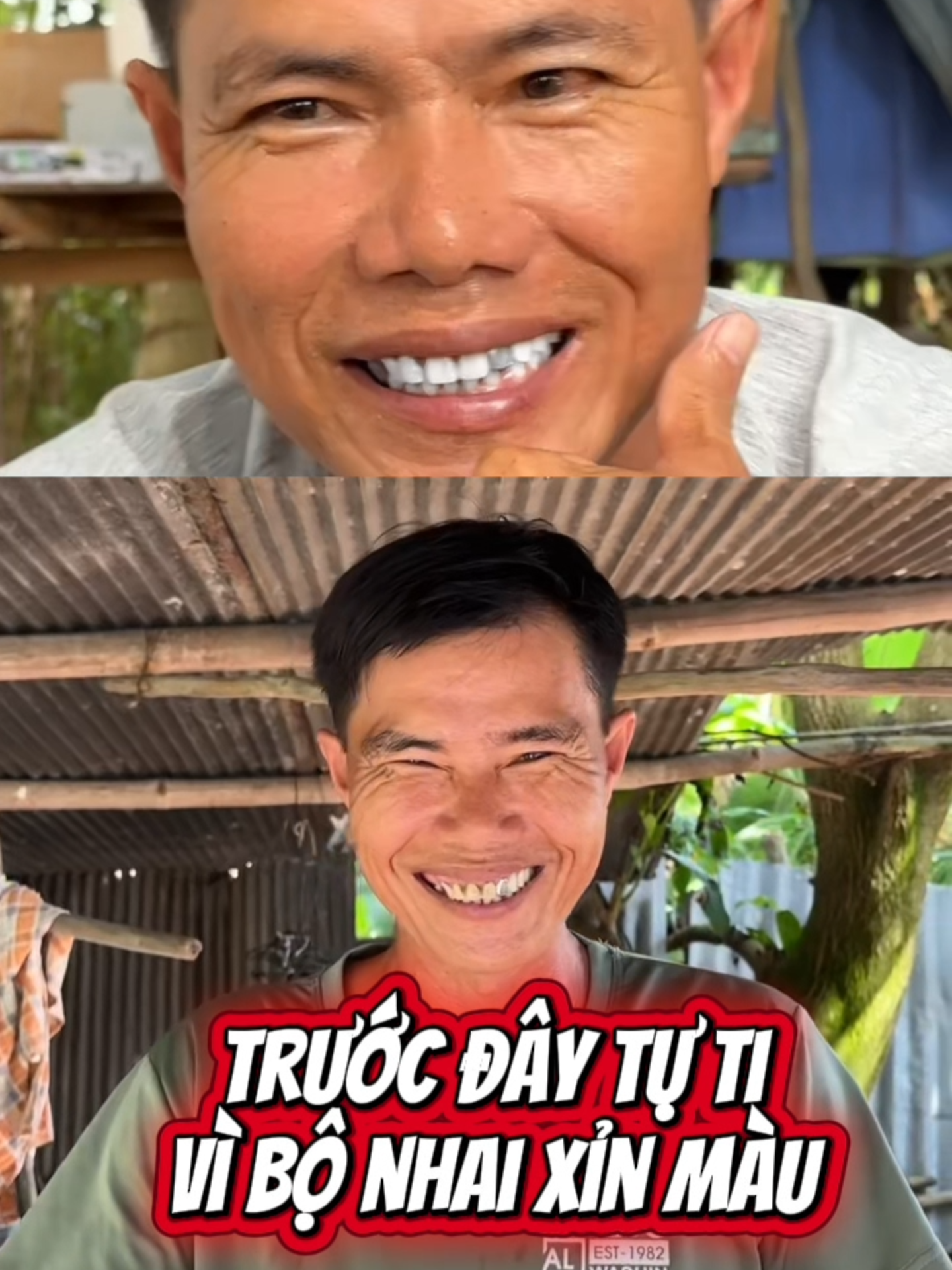 Tự ti đến nỗi không dám bước chân ra khỏi nhà #MQSkin #trangrang #saptrangrang