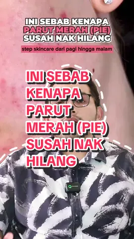 Inilah punca kenapa parut merah (PIE) awak susah nak hilang. Saya akan ajar step penggunaan skincare dari pagi hingga malam. Semoga bermanfaat 😊 #parutjerawat #acnescar #scars #beautytips #skincareroutine 