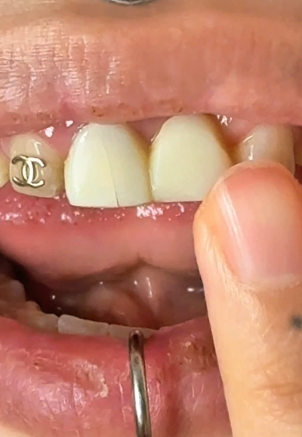 Oh no… my front tooth doesn’t look too good. 💀🦷😭  #toothfail #uglycry #sendhelp #authentic #fypシ゚ 