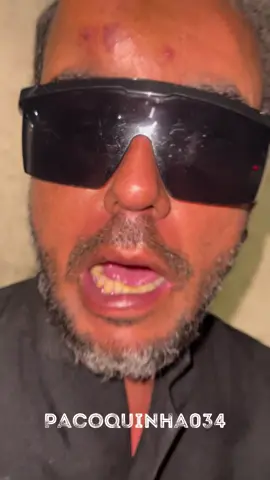 Ata Intao vc vai gritar no meu ouvido mesmo kkk  - - - - - - #comedia #reels #explore 