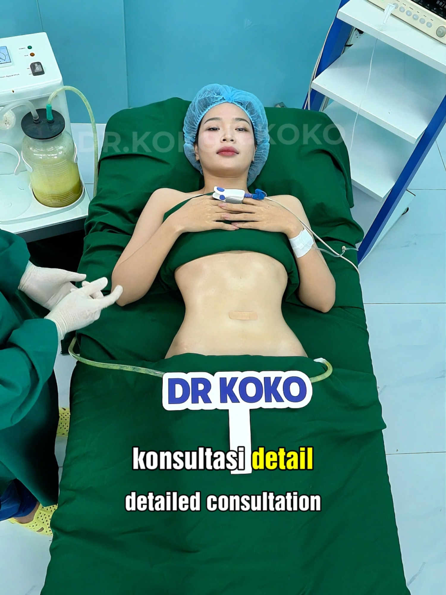 ✨ Perut rata, percaya diri meningkat! ✨ Hasil liposuction bikin bentuk tubuh lebih indah dan proporsional  #Liposuction #PerutRata #BodyGoals #OperasiKecantikan #TransformasiTubuh #PercayaDiri