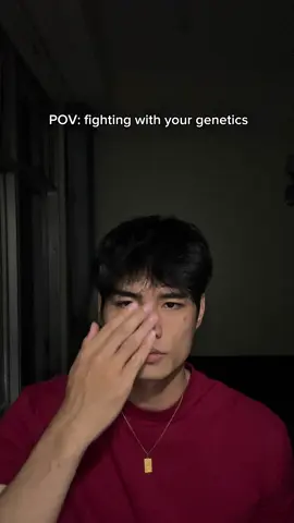 See myself in 6 months  . #hair #bald #hairline 