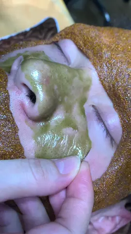 Xanh xanh #chamsocdaseo#chamsocda#chamsocdamun#chamsocdanam#tanbinh       