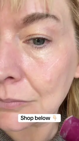 Trying the viral #korean Dr Melaxin Calcium multi balm for my wrinkles.  #tiktokmademebuyit #whatsforyou #foryoudays #beautyhacks 