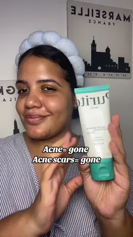 Acne? Scars? Gone  @PURITO SEOUL  #purito #panthenolcream #acnetreatment #realpostacnecream #realpostacnecreamchallenge 