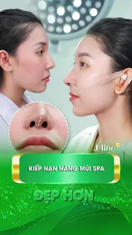 Tại sao đến bây giờ các bạn vẫn chọn nâng mũi ở Spa nhỉ?  #nangmuitrunghoa #nangmuidouyin #nangmui #viral #jlinekorea   