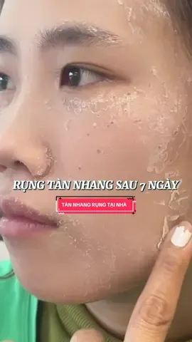 RỤNG TÀN NHANG SAU 7 NGÀY #TÀN_NHANG #đồimồiđiềutrịtạinhà #NÁM_SẠM_TÀN_NHANG #chấmtànnhang @