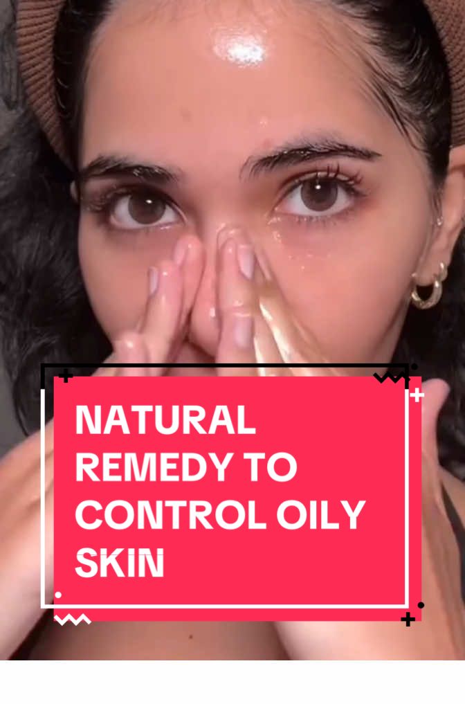 How to control oily skin naturally #oilyskin #oilyskinremedy #oilyskincontrol #skincare 