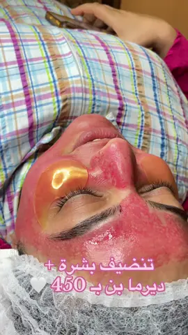 #fy #viral #skincare #viral #fyyyyyyyyyyyyyyyy 