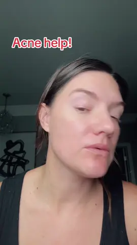 #acnetreatment #acneproneskin #tiktokshopviral @Murad Skincare 