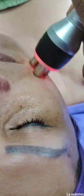 🪷@thesparosa 🪄 Radi frecuencia uno de los mejores tratamientos estéticos para reducir líneas de expresión, y es efecto tensor 🪷 Conoces este super tratamiento #cosmetologa #radiofrecuencia #efectotensor #piel firme #luminosidad 