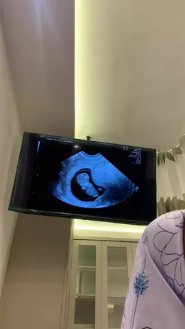 MasyaAllah Tabarakallah🥹🫶🏻 #pregnant 