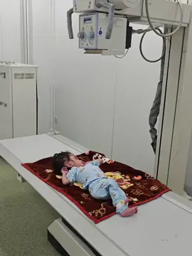 لاتزال الاجراءات الطبية والفحوصات المختبرية مستمرة لحالة الطفل عبدالله دعواتكم له أن تتكلم الإجراءات بسلام