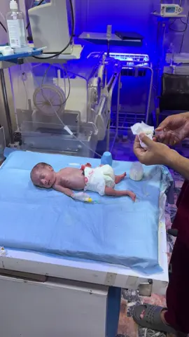 A  little hugs fretorm baby today in our nicu please pray for little heart ❤️ #unfrezmyacount#30milionvewes#virolbabyforyou#pleasetiktokteamunfrezzme