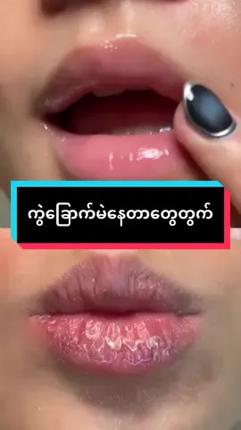 နှုတ်ခမ်းမဲတာကွဲတာတွက်1****ပဲလိုတယ်#fyp#skincare #lipmask#beauty#hellopretty
