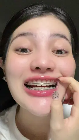 ชอบกินชากาแฟ ฟันเหลืองหินปูนหนาปากเหม้น✅🧺💛🫚✨❗️#ยาสีฟันขิงขิง 