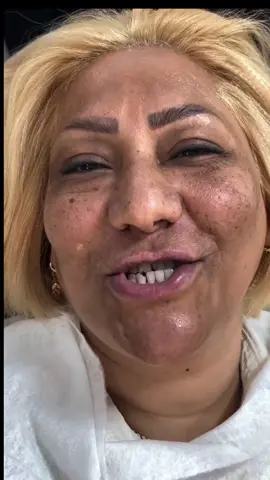 سيصدمك التغيير طبيعي لن تصدق النهاية #trending #makeup #usa #filter #France 