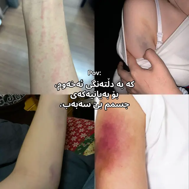 #rasty_lak #fypシ #pageeeeeforyou #fypシ゚viral🖤tiktok #fypシ @TikTok 