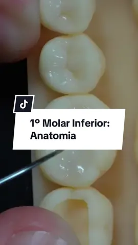 1º Molar Inferior. Quem aí gosta de esculpir um 46 tbm? #backstage #dentista #dentistica #odontologia 