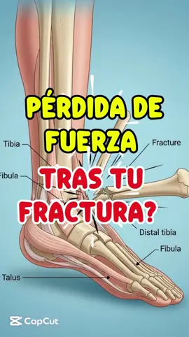 Tras una fractura de tibia y peroné, puedes perder hasta un 30% de tu fuerza en pocos meses si no haces ejercicio. Y eso es justo lo que más frena tu recuperación. #fracturatibia #fracturaperone #r3tobillo #rehabilitacion #fuerza #tobilloypie #fisioterapia #quito_ecuador🇪🇨  @Serfi 