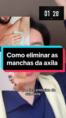 Como tirar o a crosta manchada das axilas? Uma crosta na axila pode ter várias causas, e o tratamento depende do que está provocando o problema. Aqui estão algumas possibilidades comuns: ⸻ 🔍 Causas possíveis de crosta na axila: 	1.	Dermatite de contato – Reação alérgica ou irritativa a desodorantes, sabonetes, tecidos, etc. – Pode causar vermelhidão, coceira, descamação e crostas. 	2.	Intertrigo – Inflamação da pele em áreas de dobra (como as axilas), geralmente causada por calor, suor e atrito. – Pode haver crostas se a pele lesionar ou infectar. 	3.	Infecção fúngica ou bacteriana – Exemplo: candidíase, impetigo, foliculite. – Pode haver pus, cheiro forte, dor, coceira e crostas amareladas ou escuras. 	4.	Hidradenite supurativa – Doença inflamatória crônica das glândulas sudoríparas. – Forma caroços doloridos que podem romper e formar crostas. 	5.	Psoríase ou dermatite seborreica – Doenças de pele que causam placas vermelhas com descamação e crostas. – A psoríase pode afetar as axilas (psoríase invertida). . . . #sunbbeauty #skincare #skincarecoreana #axilas #dicasdebeleza              