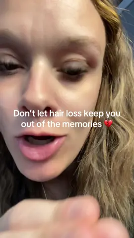 Don’t let postpartum hair loss keep you out of the holiday memories 🎄✨@Divi Scalp & Hair Health  #MomConfidence #HolidayMemories #DiviScalpSerum #PostpartumHairLoss #tiktokshopfalldealsforyou 