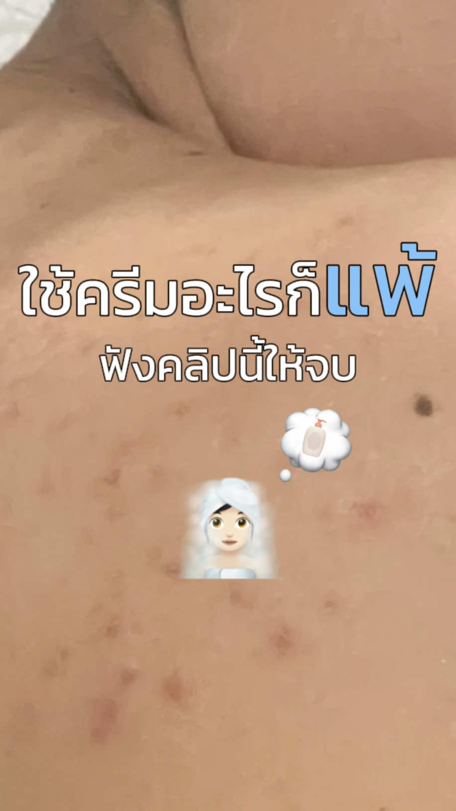 ลองให้ละ อ่อนโยนมาก 🥹#IMURA #อิมูร่า #อิมูร่าโลชั่น #อิมูร่าลิปมาส์กดราก้อนบลัด #สิว 