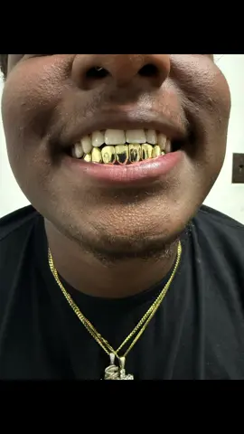 Let the Pro Handle your Grillz at @Grillzpro  10K Gold 8 Bottom with #deepcuts  Orders your BEST DEEPCUTS/PERMCUTS GRILLZ today Call text 813-525-5539 Or DM Order online www.grillzpro.com Walk-in are welcome At 4912 Southfork dr lakeland inside Dental Office 863-606-2212  #grillzpro #gold #goldteeth #lakelandflorida