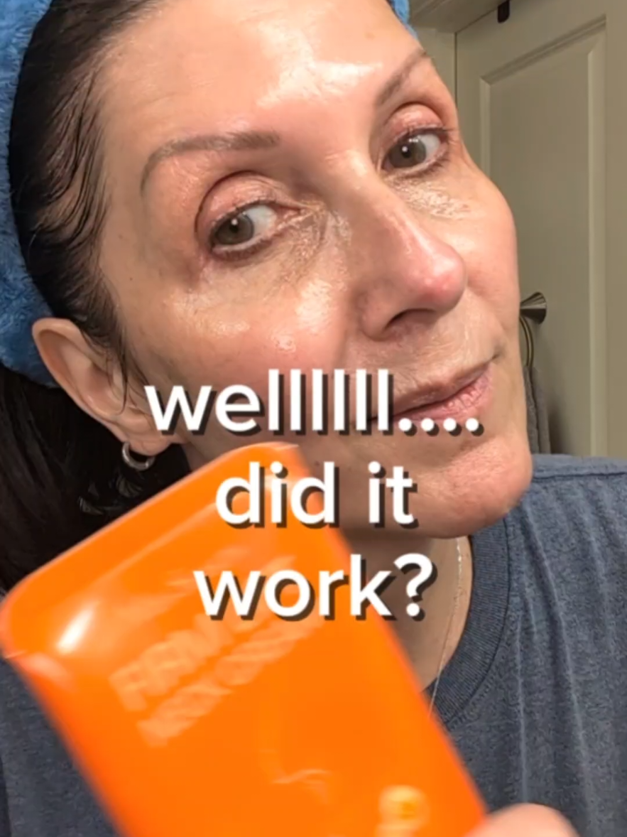 Did it work? Yes it did. It definitely didn't reverse the work I had already done. #neckcream #firming #lifting #proxylane #collagencream 