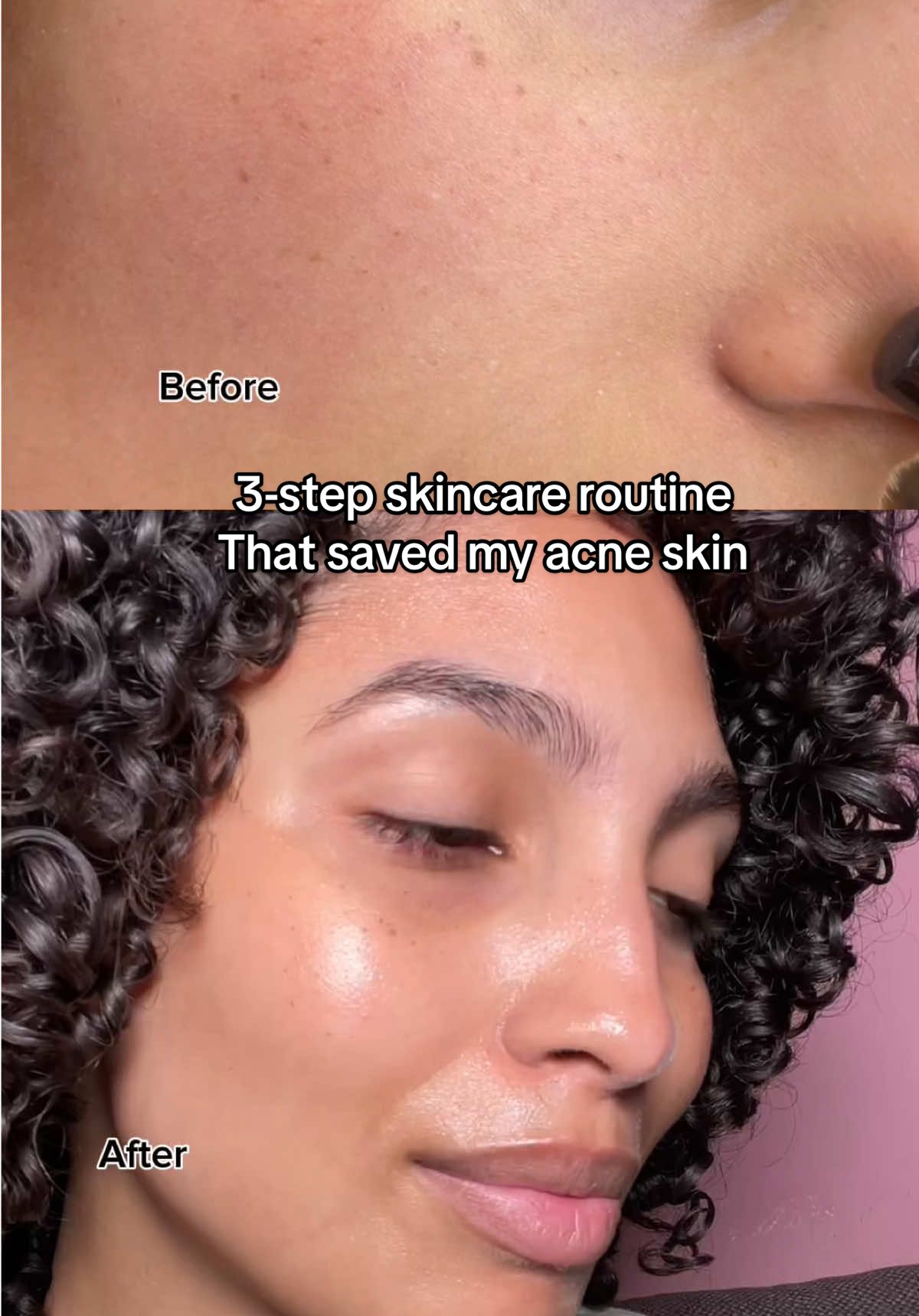 3 steps routine with @PURITO SEOUL  #purito #panthenolcream #acnetreatment #realpostacnecream #realpostacnecreamchallenge 