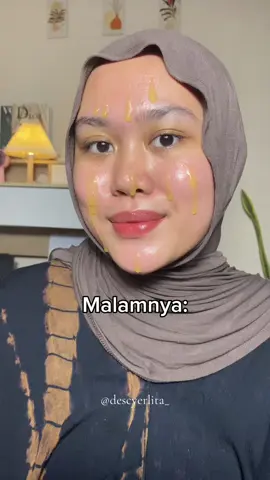 Glowing bgtt pas bangun tidur😍 #serum #msglow #skincare #skincareroutine #rekomendasiskincare #reviewjujur #gayaditiktok 