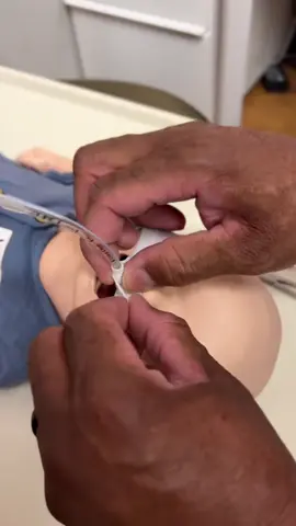 🫁✨ What’s Needed for an Intubation ✨🫁 When it’s time to secure an airway, preparation is everything. Here’s the essential intubation checklist every RT or medical professional should know: 🔹 Airway Equipment 	•	Endotracheal tubes (multiple sizes) 	•	Stylet 	•	Laryngoscope (Mac & Miller blades, or video laryngoscope if available) 	•	Suction setup (Yankauer + catheter) 🔹 Ventilation & Oxygenation 	•	Bag-valve mask (BVM) with O2 source 	•	Oral or nasal airways 🔹 Confirmation & Securing 	•	End-tidal CO₂ detector / capnography 	•	Stethoscope 	•	Tube holder or securing device 🔹 Backup & Emergency Tools 	•	Bougie / introducer 	•	LMA (laryngeal mask airway) 	•	Cricothyrotomy kit (if needed) ⚡️ Pro Tip: Always check your equipment BEFORE starting. A smooth intubation is all about preparation and teamwork! #intubation #airwaymanagement #criticalcare #rtlife #emergencymedicine 