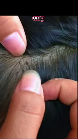 #lice 