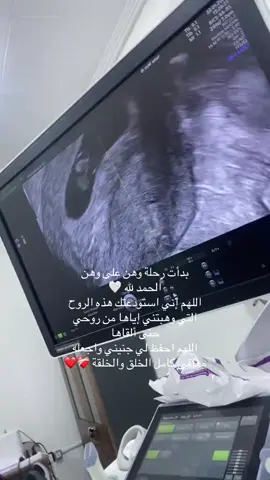 #الانتشار_السريع #الحمل_و_الولادة #حمل #اكسبلور #fypシ゚viral 