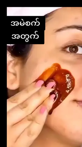 အမဲစက်သမားများအတွက် #100k #views #fpy #တင်းတိပ်အမဲစက်မှဲ့ခြောက်ပျောက် #အလှပအကြောင်းအမြဲတင်မယ် 