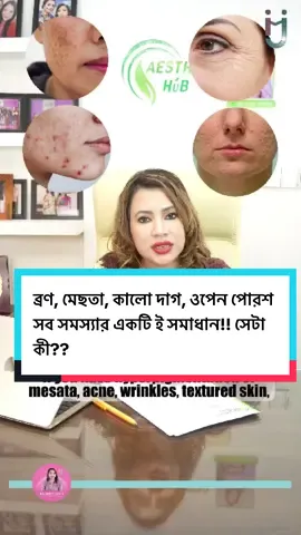 ট্রেটিনোইন ক্রিম কিসের জন্য কাজ করে? | Tretinoin |                                                   #skincare #skin #skincaretips #acne #melasma call: 01737091619