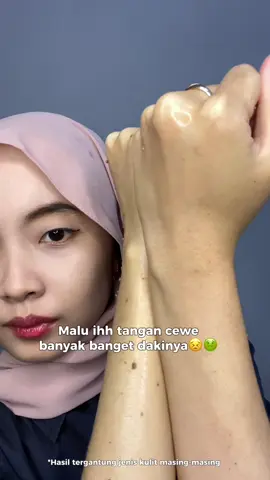 Rajin rajin ekfoliasi pake Peeling Gel Reglow guys🥰#SaatnyaReglow 