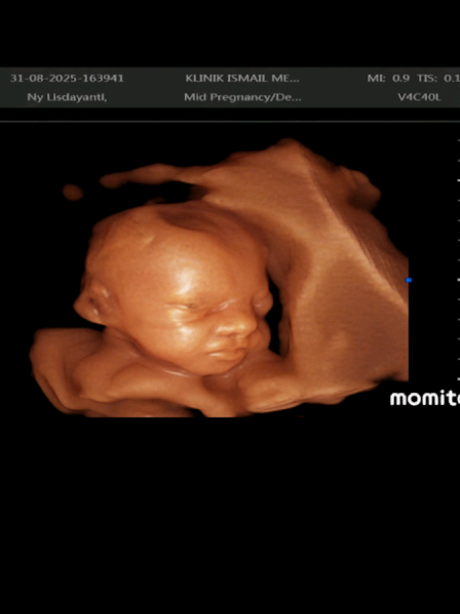 sehat ya kesayangan 🩷 #baby  #masyaallahtabarakkallah  #27weekspregnant 