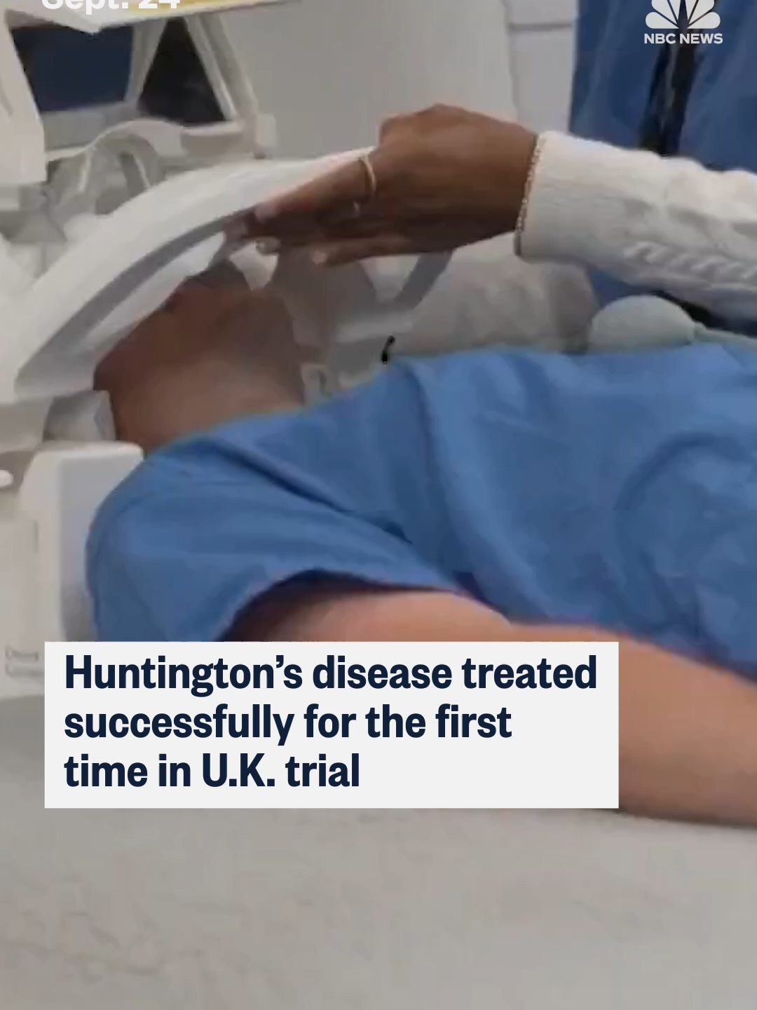 An experimental gene therapy has been found to slow the progression of Huntington’s disease, according to drugmaker uniQure, a major step towards the first genetic treatment for the genetic and fatal condition.